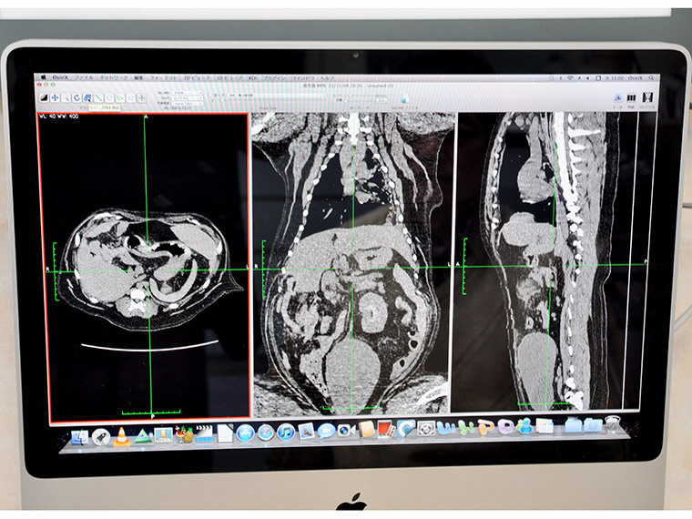 院内はデジタル回線で結ばれており診察室で、CT画像をチェックすることもできます。